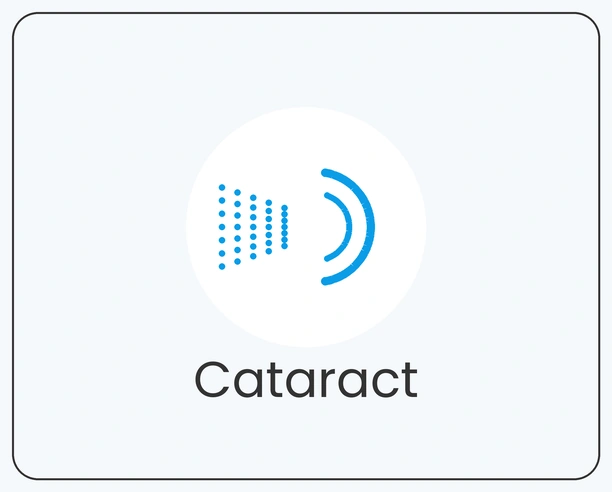 Cataract